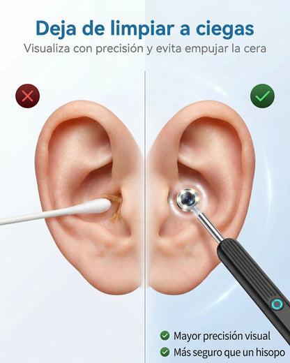 EarVision Pro™ – Limpieza Inteligente con Cámara HD