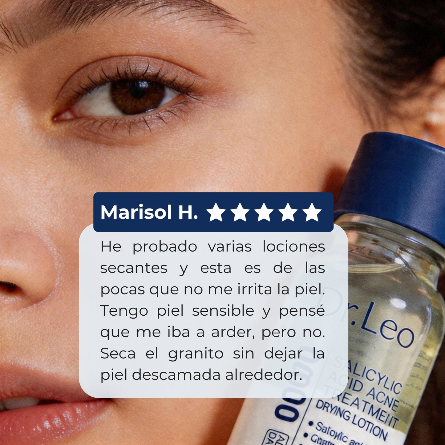 Dr. Leo | Acne Treatment